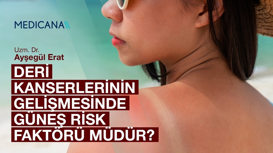 Deri Kanserlerinin Gelişmesinde Güneş Risk Faktörü Müdür?