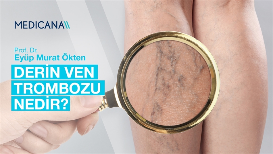 Derin Ven Trombozu Nedir?