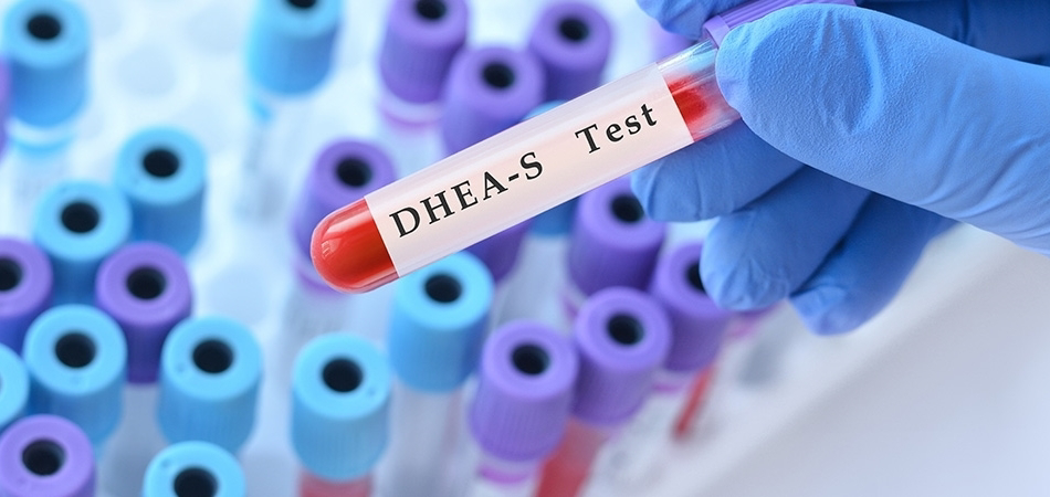 DHEA-S nedir? Kadınlarda androjen fazlalığı değerlendirmesindeki rolü