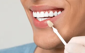 Diş kaplama: Klinik rehber ve hasta kılavuzu
