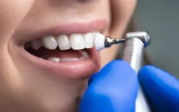 Diş temizliğinin faydaları neler? Diş temizliği nasıl yapılır?