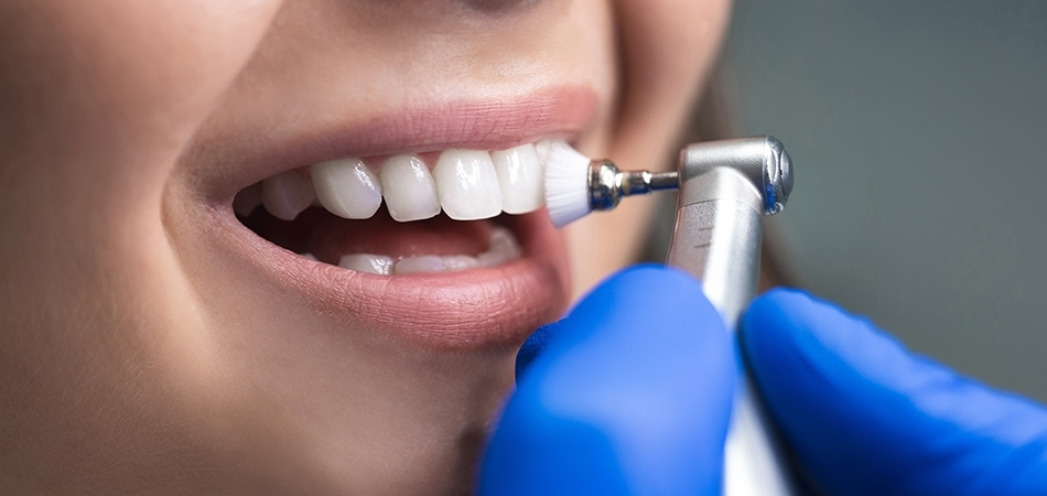 Diş temizliğinin faydaları neler? Diş temizliği nasıl yapılır?
