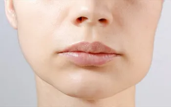 Dişten yanak şişmesi neden olur? Dişten dolayı yanak şişmesine ne iyi gelir?