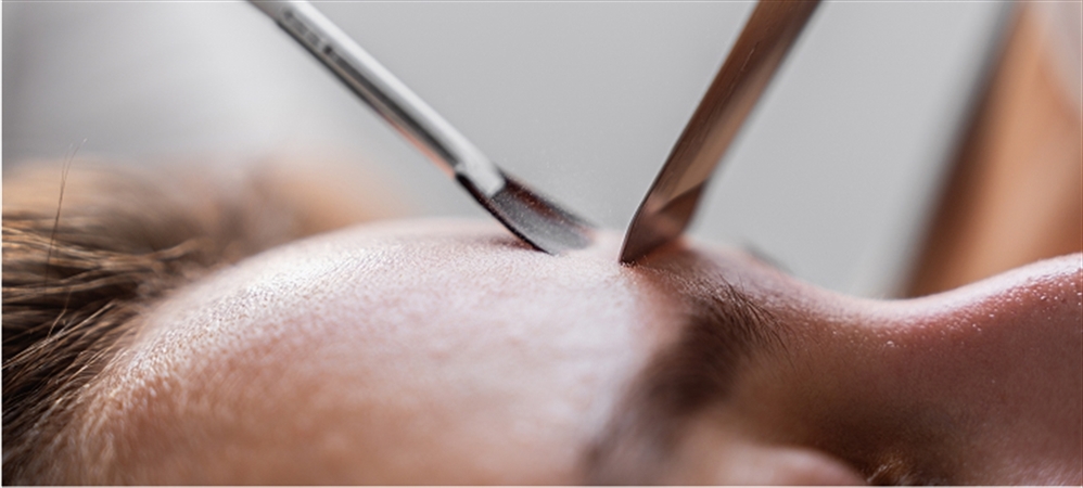 Kıl dönmesi belirtileri nelerdir? Kıl dönmesi nasıl geçer?