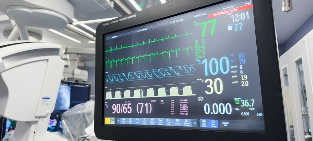 EKG ne demek? EKG çekimi kaç saat sürer?