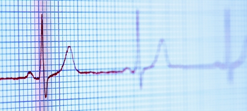 EKG nedir? EKG ne için çekilir?