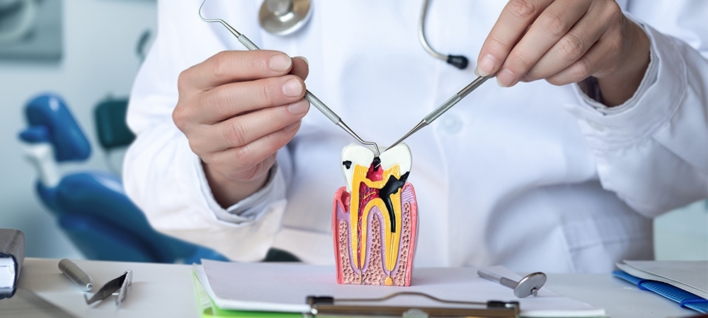 Endodonti ne demek? Endodonti bölümü neye bakar?
