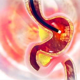 Endoskopi Nedir? Nasıl Yapılır? Endoskopi Sırasında Dikkat Edilmesi Gereken Noktalar