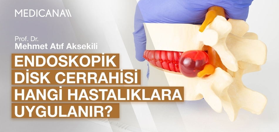 Endoskopik Disk Cerrahisi Hangi Hastalıklara Uygulanır?