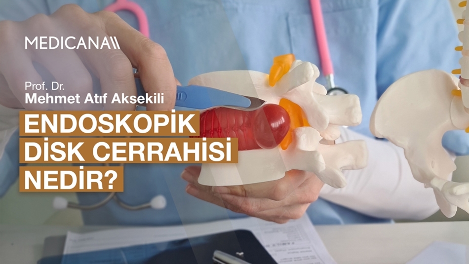 Endoskopik Disk Cerrahisi Nedir?