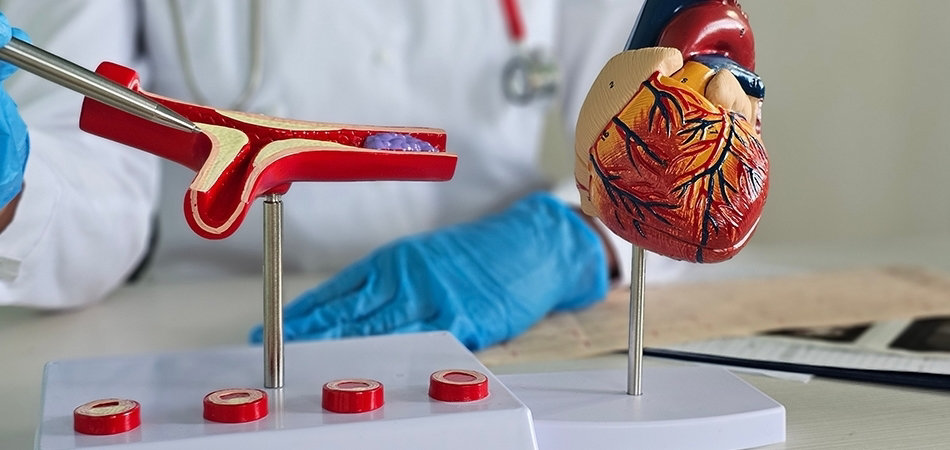 Enfarktüs nedir? Enfarktüs neden olur?