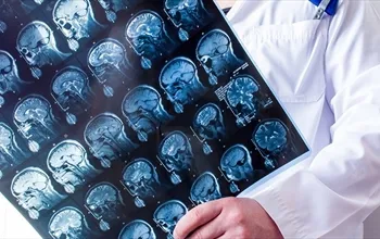 Ensefalopati nedir? Ensefalopati iyileşir mi?