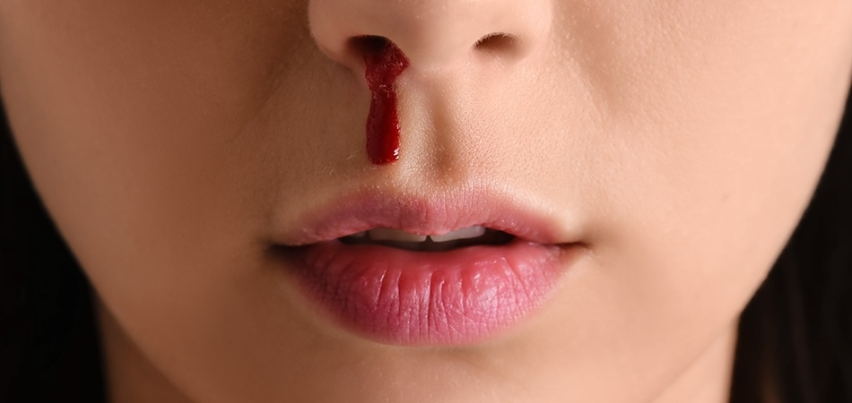 Epistaksis nedir? Epistaksis neden olur?