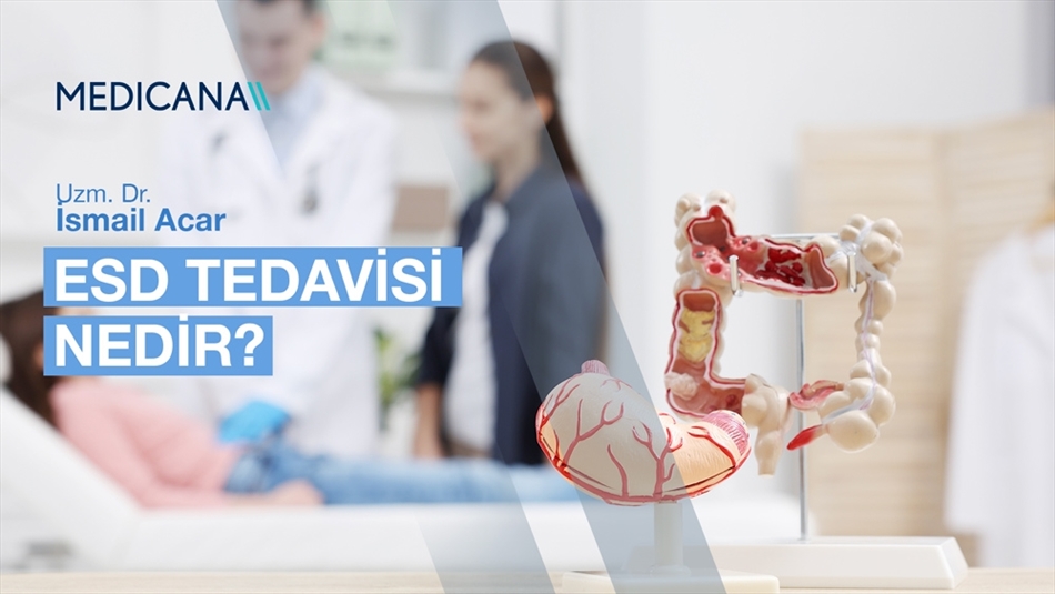 ESD Tedavisi Nedir?