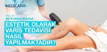 Estetik Olarak Varis Tedavisi Nasıl Yapılmaktadır?