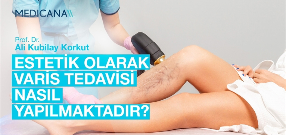 Estetik Olarak Varis Tedavisi Nasıl Yapılmaktadır?