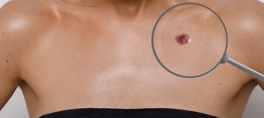 Et beni neden olur? Et beni neyin belirtisi olabilir?