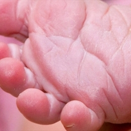 Fenilketonüri Nedir?