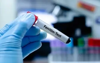 Ferritin düşüklüğü ve yüksekliği ne anlama gelir? Ferritin kaç olmalı?
