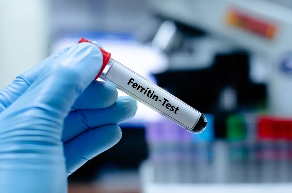 Ferritin nedir? Ferritin düşüklüğü/ yüksekliği ne anlama gelir? Ferritin nedir? Ferritin düşüklüğü/ yüksekliği ne anlama gelir?