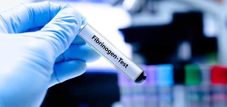 Fibrinojen nedir? Fibrinojen ne işe yarar?