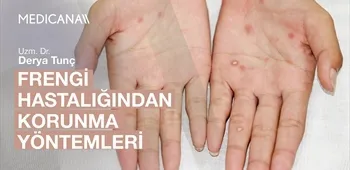 Frengi Hastalığından Korunma Yöntemleri Nelerdir?