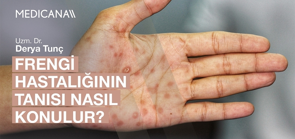 Frengi Hastalığının Tanısı Nasıl Konulur?