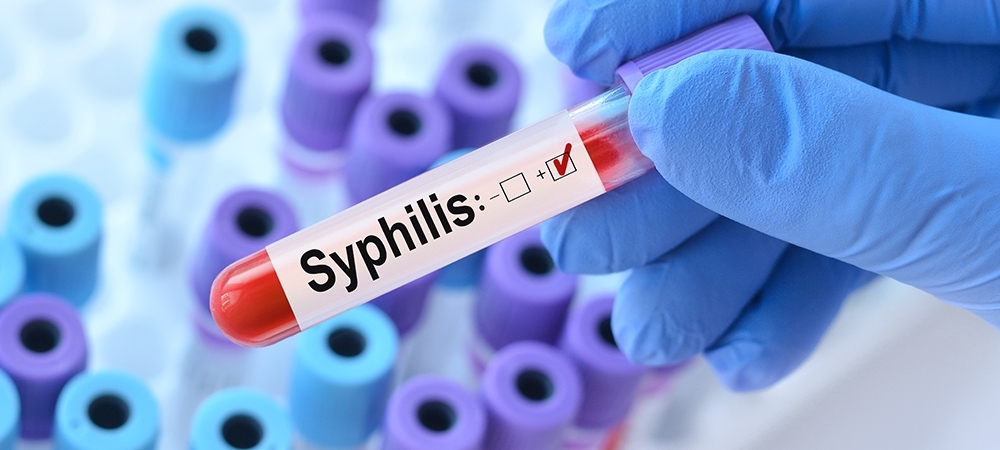 Frengi nasıl bir hastalıktır? Frengi tamamen iyileşir mi?