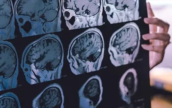 Frontotemporal demans türleri