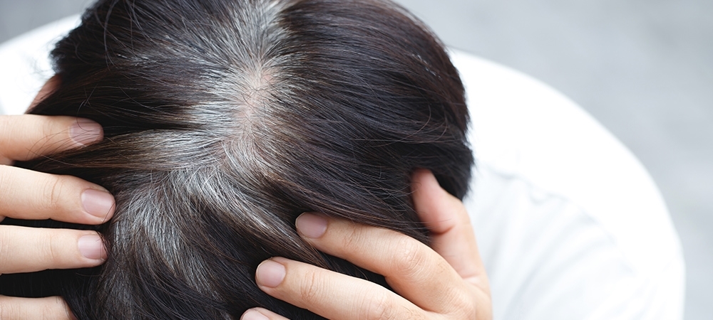 Genç yaşta saç neden beyazlar? Saç beyazlaması durdurulabilir mi?