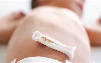 Göbek bağı nedir? Yenidoğan bebekte göbek bağı ne zaman düşer?