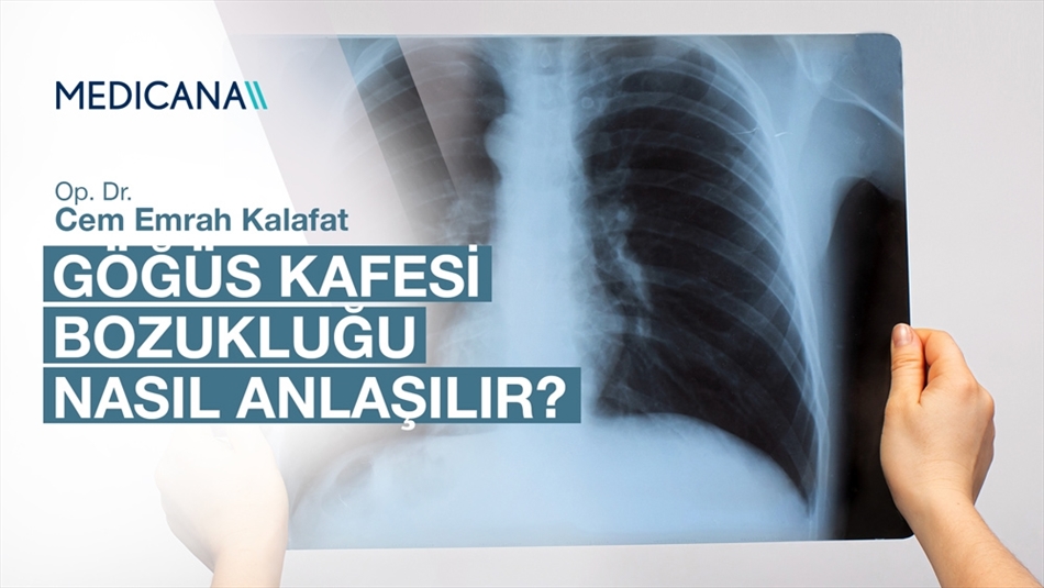 Göğüs Kafesi Bozukluğu Nasıl Anlaşılır?