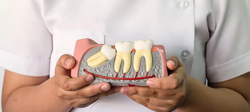 Gömülü diş çekilmezse ne olur? Gömülü diş kendiliğinden çıkar mı? Gömülü diş çekilmezse ne olur? Gömülü diş kendiliğinden çıkar mı?