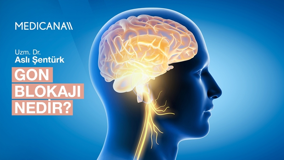Gon Blokajı Nedir?