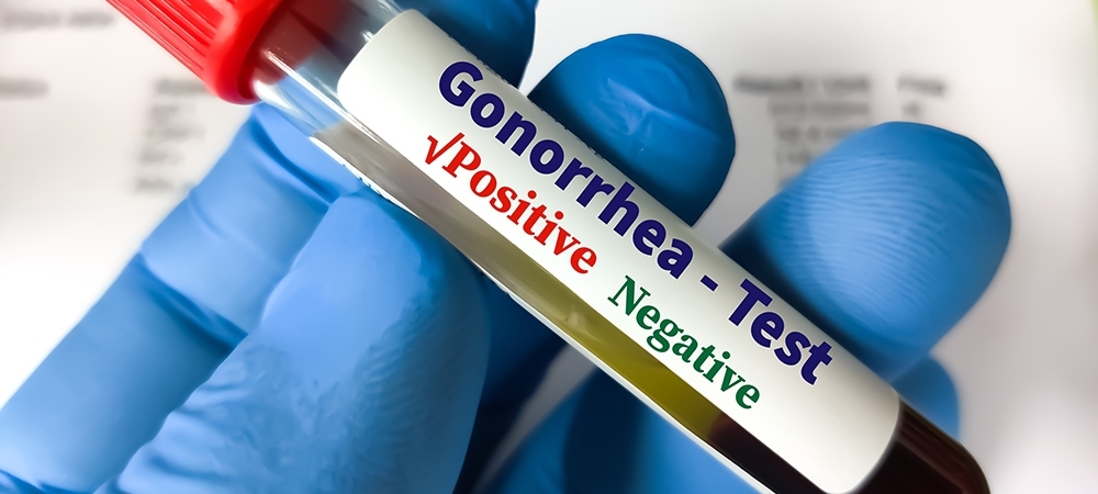 Gonore nasıl bir hastalıktır? Gonore olduğunu nasıl anlarız?