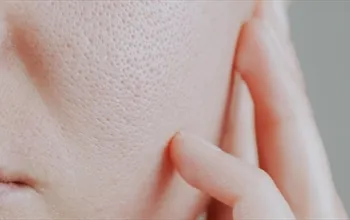 Gözenek küçültmek için ne yapılmalı? En etkili gözenek tedavisi nedir?