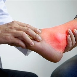 Gut Hastalığı Nedir? Belirtileri ve Tedavisi