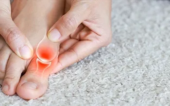 Gut krizi: Ani eklem ağrısının arkasında ne var?