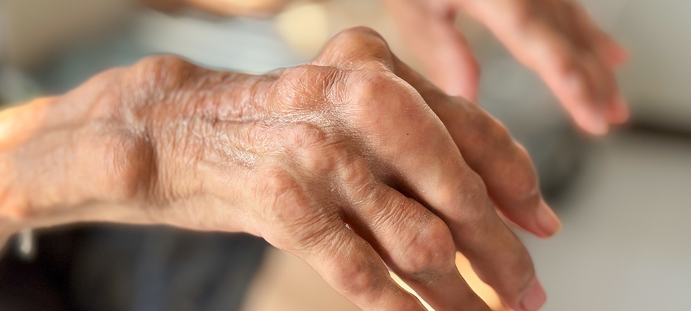 Gut hastalığı nedir? Gut hastalığı olanlar nasıl beslenmeli?