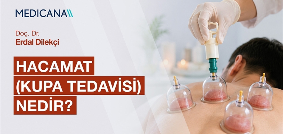 Hacamat Kupa Tedavisi Nedir?