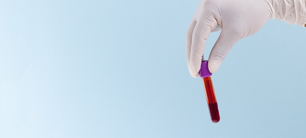 Alt yüksekliği ne anlama gelir? Alanin Aminotransferaz (ALT) düşüklüğü/yüksekliği nasıl değerlendirilir?