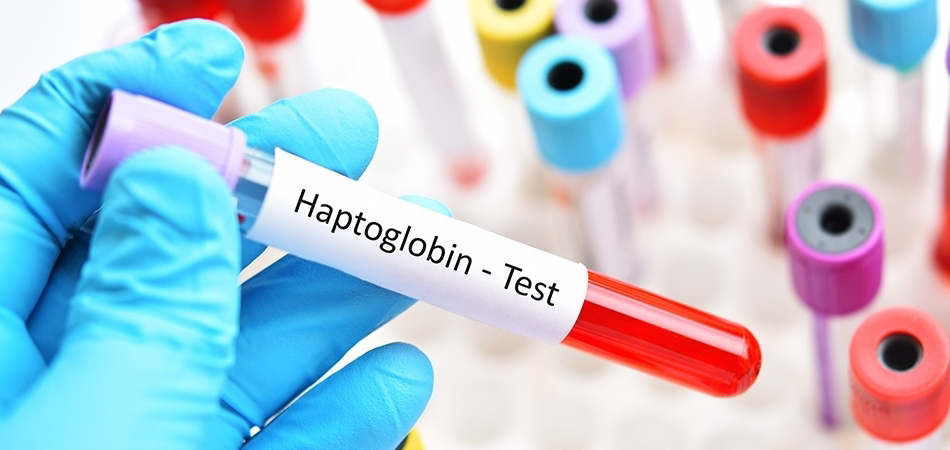 Haptoglobin nedir? Kan tahlilinde haptoglobin düşüklüğü ve yüksekliği ne anlama gelir