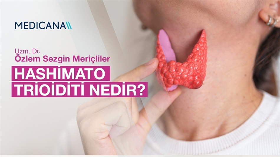 Hashimato Trioiditi Nedir?