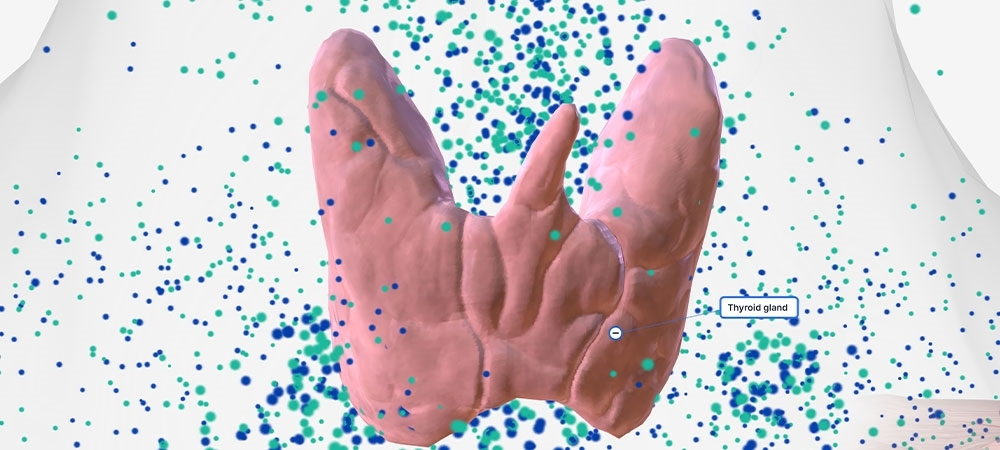 Haşimato olunca ne olur? Haşimatosu olanlar ne yememeli?