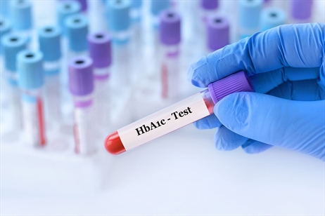 Hba1c Nedir?