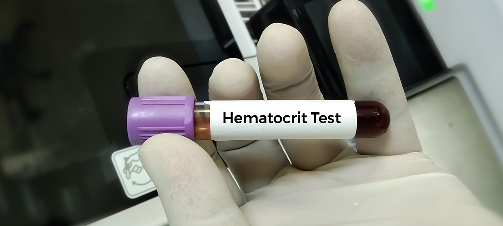 HCT (hematokrit) ne demek? HCT yüksekliği neden olur?