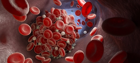 HDL kolesterol nedir? HDL düşüklüğü / yüksekliği ne anlama gelir?