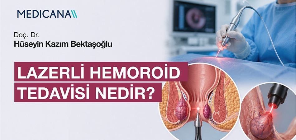 Lazerli Hemoroid Tedavisi Nedir?