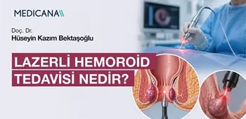 Lazerli Hemoroid Tedavisi Nedir?