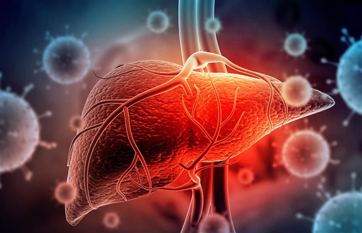 Hepatit A Nedir? Belirtileri, Tedavisi & Bulaşma Yolları